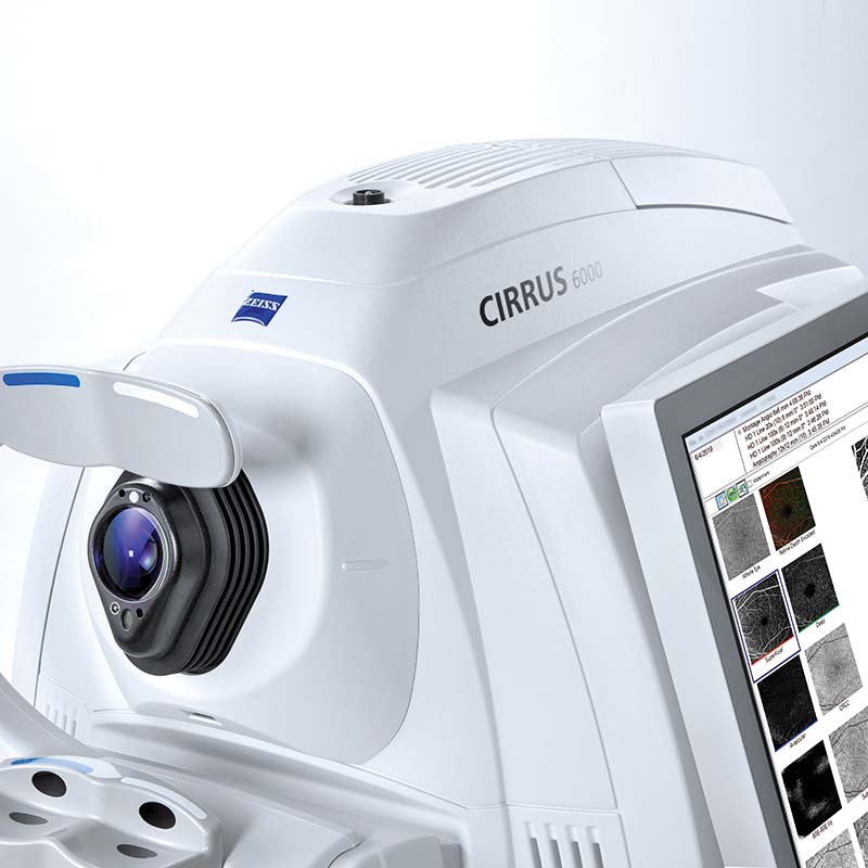 ZEISS CIRRUS 6000. Make every second count with high-performance OCT