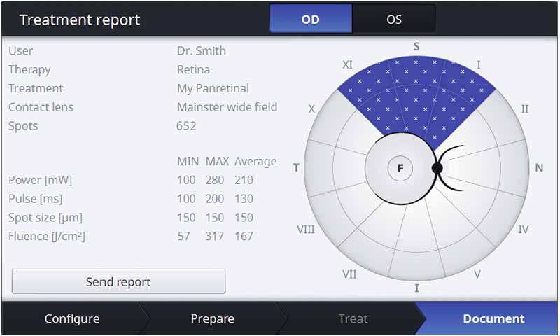 ZEISS VISULAS Green. Unmatched workflow efficiency in laser therapy.