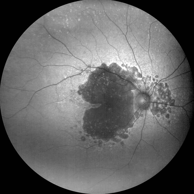 ZEISS CLARUS 500. Imaging ultra-wide without compromise.