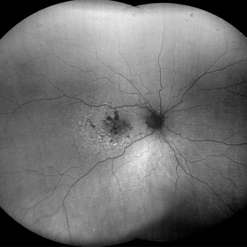 ZEISS CLARUS 500. Imaging ultra-wide without compromise.